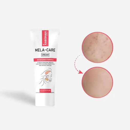 Kabishah Mela-Care Dark Spot Cream